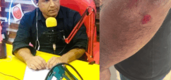 Brutal agresión y abuso de autoridad contra el periodista Daro Navarro en José C. Paz